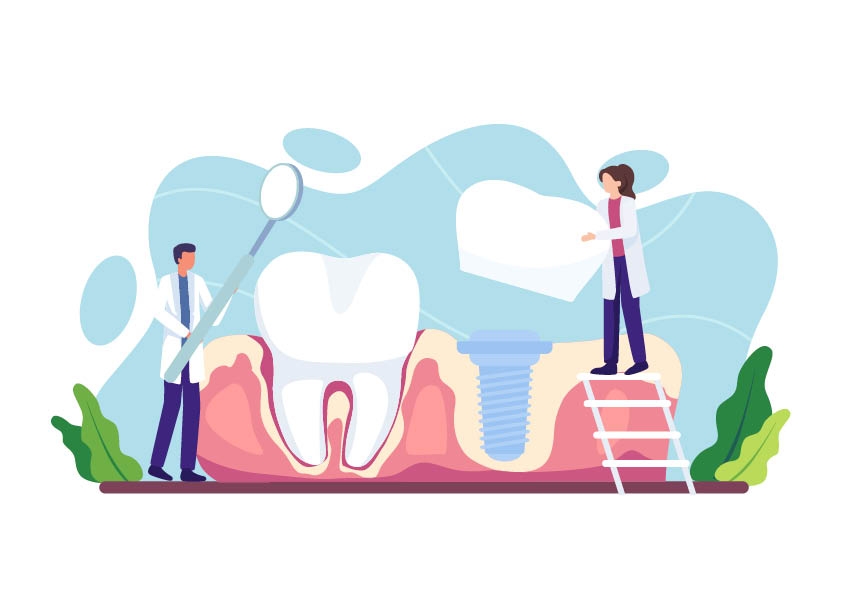 Die Vorteile einer Implantatversorgung